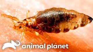 Botfly Larvae Living In Young Womans Scalp  Monsters Inside Me  Animal Planet [upl. by Inafetse673]