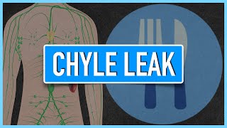 Chyle Leak  Emphasis on DietNutrition [upl. by Durnan]