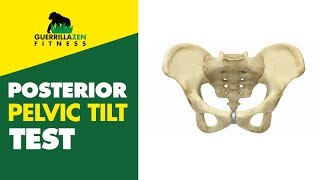 Posterior Pelvic Tilt Test  Do this one at home easily [upl. by Leihcim]