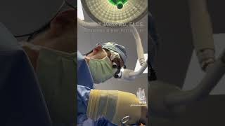 Ethnic rhinoplasty  Anthony Bared MD FACS  Miami FL [upl. by Healy]