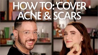 How To Cover Acne amp Scars  Sephora [upl. by Reniti]