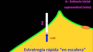 Estrategias de Umbral y Supraumbral  Centro de Oftalmología Bonafonte Barcelona [upl. by Anohsal682]