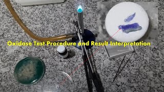 Oxidase Test Positive Procedure Result and Interpretation [upl. by Sherfield778]