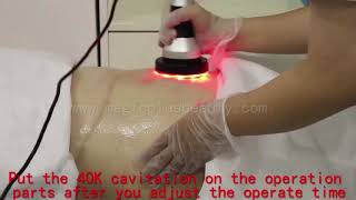 Beauty machine Cryoliposis Fat freezing Slimming Machine Operation Video [upl. by Nonaihr895]