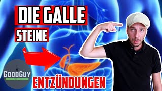 Die GalleGallensteineSchmerzen und deren Ursache [upl. by Frederica]