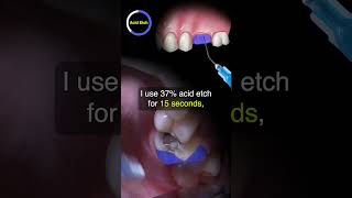 Cementing a FullySintered Zirconia Crown  Ep 5 dentalshorts [upl. by Jea]