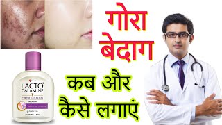 Lacto Calamine face lotion HONEST Review 2023 in hindi  Results Benefits Uses Price Info [upl. by Einnil516]