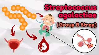 Streptococcus agalactiae A Detailed Look at Physiology Virulence Factors amp Clinical Significance [upl. by Isabelle]