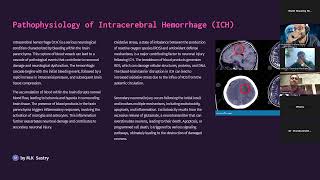 Pathophysiology of intracerebral hemorrhage Fellowship class MK Sastry 061224 Stroke Understanding [upl. by Ahsirt936]