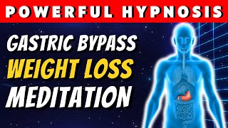 Gastric Bypass Hypnosis For Weight loss [upl. by Zerelda]