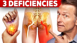 The 3 Vitamin Deficiencies in Sciatica and Carpal Tunnel Syndrome [upl. by Aronson52]