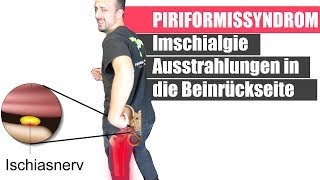 Piriformis Syndrom amp Ischiasschmerzen durch schwache Pomuskulatur  Dehnen hilft NICHT [upl. by Jedlicka]