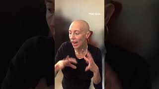 Woman living with alopecia reacts to 4B movement [upl. by Akinad]