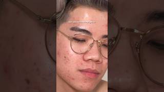 The SECRET to clear skin acne skincare skincareroutine [upl. by Nednyl859]