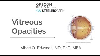 Part 1 Vitreous Anatomy [upl. by Leaffar779]