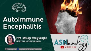 Autoimmune Encephalitis by Prof Jithangi Wanigasignhe [upl. by Noryahs]