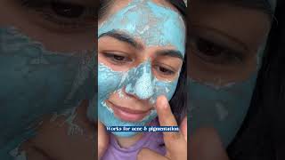 Facemask to melt whiteheads amp blackhead skincare facemask whiteheads blackheads shortsfeed [upl. by Kursh]