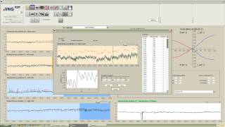 eVNG Caloric Settings [upl. by Ycnalc]