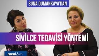 Sivilce nasıl geçer Suna Dumankayanın önerisi  Sağlık  Nasilcom [upl. by Betty427]