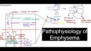 Emphysema Pathophysiology [upl. by Ammann719]