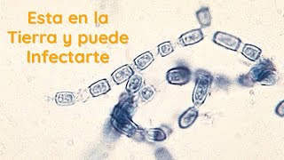 Este Hongo Está en la Tierra y puede Infectarte  Coccidioides [upl. by Adnohr]