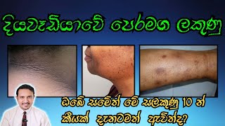 10 changes of skin  දියවැඩියා අවදානම කලින්ම දැනගන්න DrChiranjaya  HealthySkinlk [upl. by Neerehs]