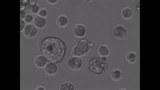 Unicellular relatives of animals Sphaeroforma arctica [upl. by Andres]