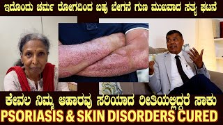 Live Story of PSORIASIS cured by Food as Medicine by Dr S M Raju IAS Rtd [upl. by Willow]