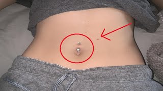 how to get rid of a belly button piercing infection fast [upl. by Eener]