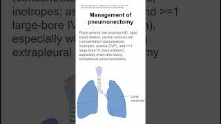 Management of pneumonectomy [upl. by Gibbie]