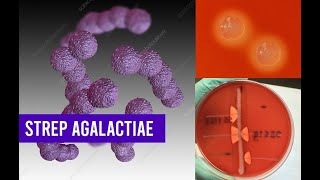 Streptococcus Agalactiae Bacteria  Complete Overview [upl. by Charleton]