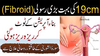 Baghair Operation Rasoli Ka Khatma  Surah AshShura Ka Powerful Amal  Fibroid Treatment From Quran [upl. by Norej]