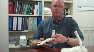 Ankle Replacement Procedure  Ankle Arthritis Pain  Dr Eric Malicky  Orthopaedics [upl. by Pablo]