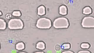 Automatic Manipulation of Cells Inside Microfluidic Chamber Assisted by Optical Tweezers [upl. by Joub]