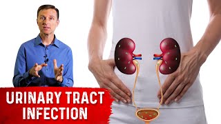 Top Remedies for a UTI Urinary Tract Infection Updated [upl. by Jacobs]