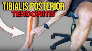 3 Exercises for Tibialis Posterior Tendonitis [upl. by Eusadnilem]