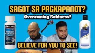 HOW TO CURE BALDNESS Philippines  11 November 2020 [upl. by Miun]