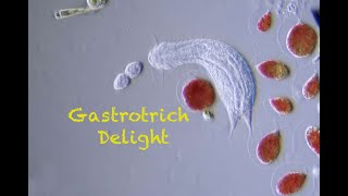 Gastrotrich Delight [upl. by Symons836]