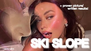 SKI SLOPE NOSE  proven results [upl. by Drofniw923]