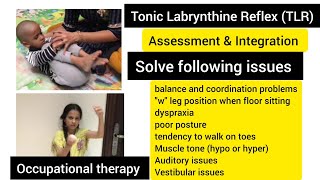 Tonic labyrinthine reflex TLR How to test amp integrate TLR primitive reflexoccupational therapy [upl. by Gimpel30]