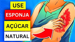 12 PLANTAS QUE SÃO ESPONJAS DE AÇÚCAR NO SANGUE [upl. by Hollington]