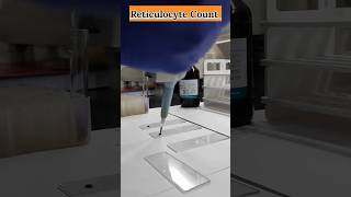 Reticulocyte Count Full Process youtubeshorts viral shortsvideo dmlt ytviral feedshorts [upl. by Marcelo]