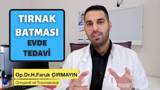 Tırnak Batması 6 Etkili Yöntem ile Evde Tedavi [upl. by Gunnar]