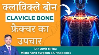 clavicle bone fracture treatment in Hindi  broken collar bone  clavicle bone  clavicle fracture [upl. by Noislla]