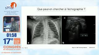 APELIP 2022 Échographie thoracique en pédiatrie  Quelles indications  Pr LChat [upl. by Isadore]