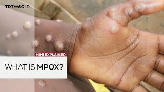 What is mpox the viral outbreak now a public health emergency in Africa [upl. by Yelraf]