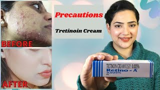 Retino A 0025cream  Before And After Tretinoin Cream PRECAUTIONS  My experience with Tretinoin [upl. by Anirat]