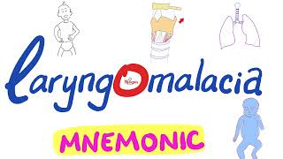 Laryngomalacia Mnemonic  Pediatrics ENT [upl. by The470]