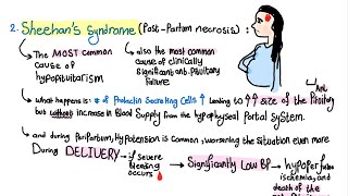 Sheehans Syndrome in one minute [upl. by Zed]