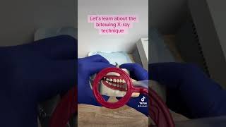 How to take bitewing Xrays dentalassistant dentalassistanteducation dentalhygienist dentist [upl. by Rehtaeh]